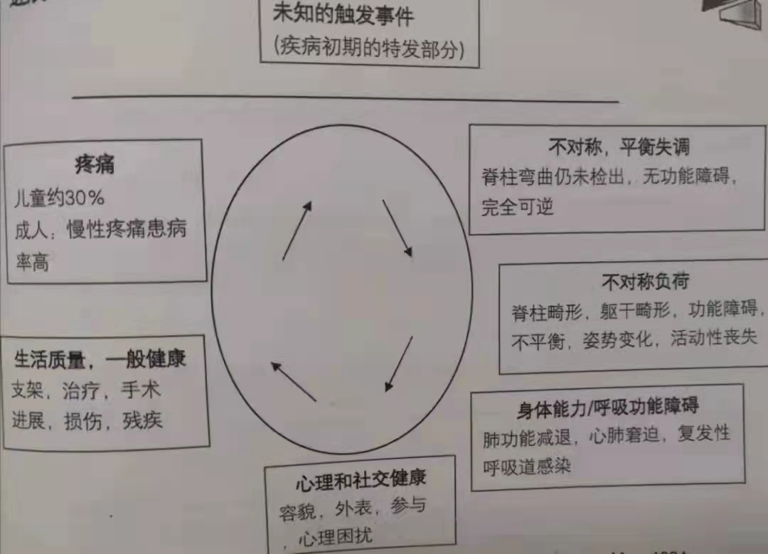 脊柱侧弯